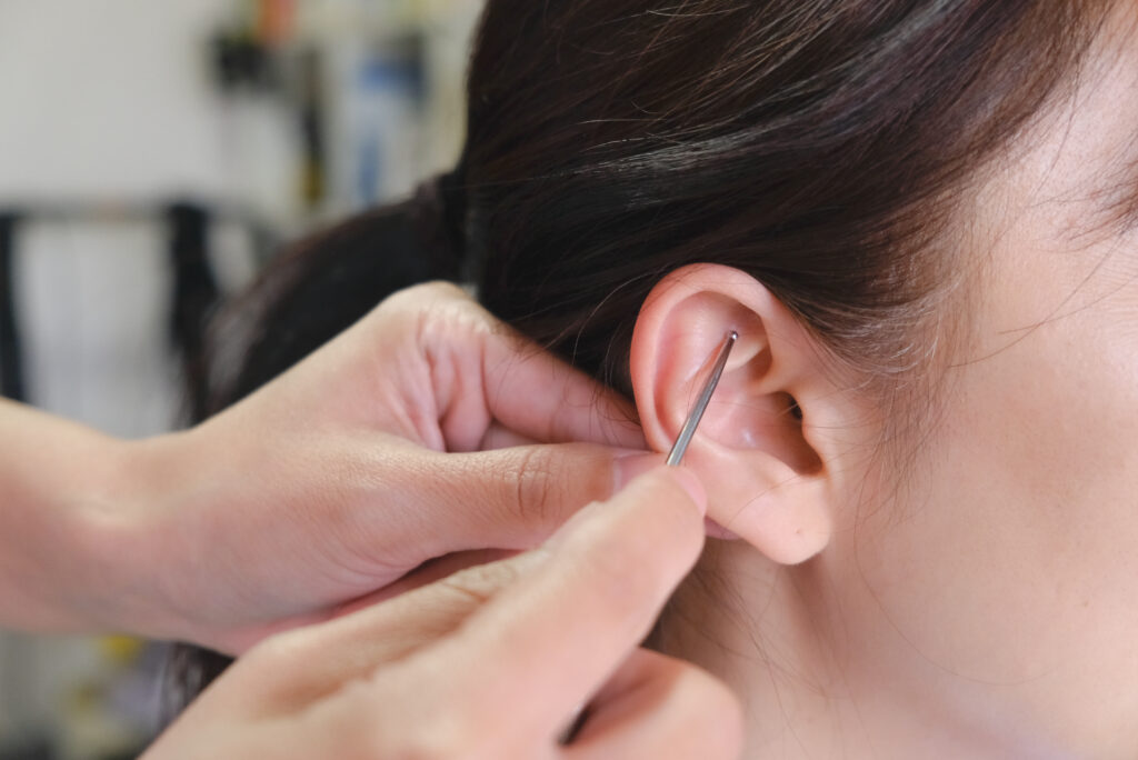 Ear acupressure therapy